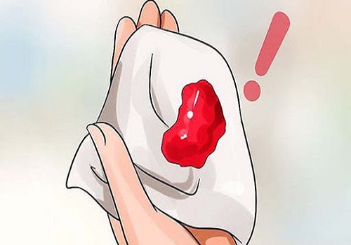 Đau rát, chảy máu khi quan hệ là triệu chứng điển hình của bệnh viêm lộ tuyến cổ tử cung